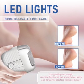 Electric Foot File with 2 Speeds & LED Display, Rechargeable Callus Remover with 3 Grit Heads (Coarse/Medium/Fine), Pedicure Tools for Feet Hard Skin Smooth Polishing (White)