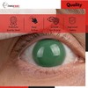 Corneal Shield Protector, Pack of 3 Pairs