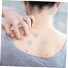 FRCOLOR Patches for Face 144 Sheets Hydrocolloid Pimple Sticker Scar