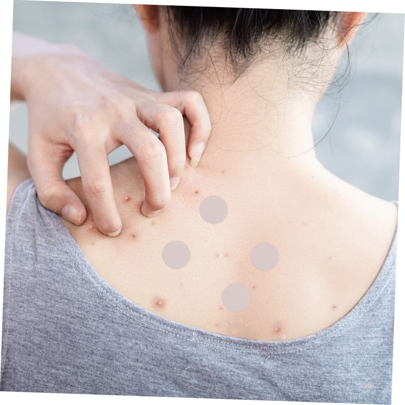 FRCOLOR Patches for Face 144 Sheets Hydrocolloid Pimple Sticker Scar