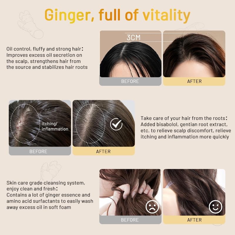QUARXERY Shampoo Anticaída Ginger Pro Shampoo: y Cabello Graso con