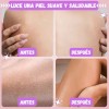 Exfoliante Corporal Piel Suave Ultramo Nutritivo Hidratante Piña