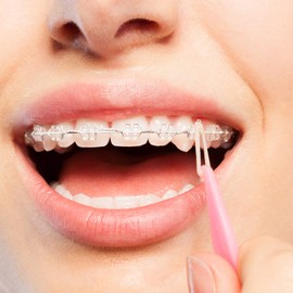 JMU Orthodontic Elastics 1/8 Heavy, 100 Pack 6.5 oz Intraoral Elastic Bands Latex Free Dental Rubber Bands Made in USA