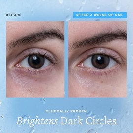 belif Gel Refrescante Para Ojos Aqua Bomb Cafeína Y Ácido Hialurónico Para Reducir La Hinchazón E Hidratar Niacinamida Y Vitamina C Para Las Ojeras Ad