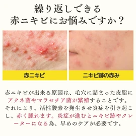 Dr. Re9 (Medicinal) Berlian Acne Care VC Lotion (Soothes Adult Acne, Red Acne, Inflammation Acne, Leaves No Trace of Acne), Allantoin Oil-Soluble Vitamin C Formulated