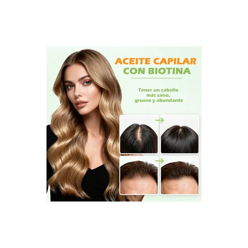 Aceite Para Cabello Aceite Capilar De Biotina 150 Ml Aceite