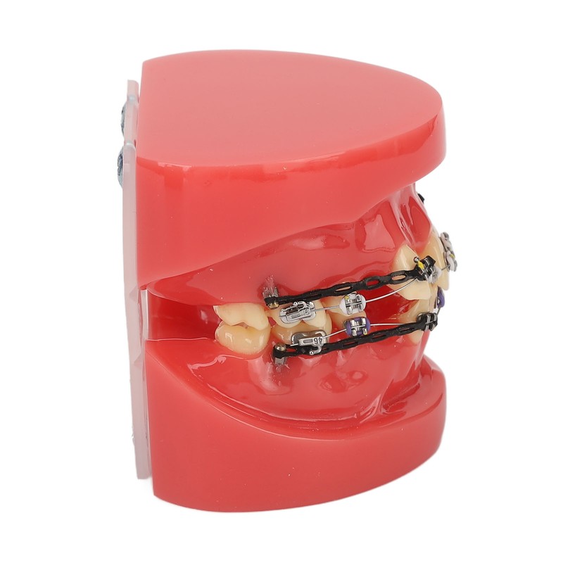 Professional Dental Demonstration Orthodontic Model with Metal Wires and Bracket