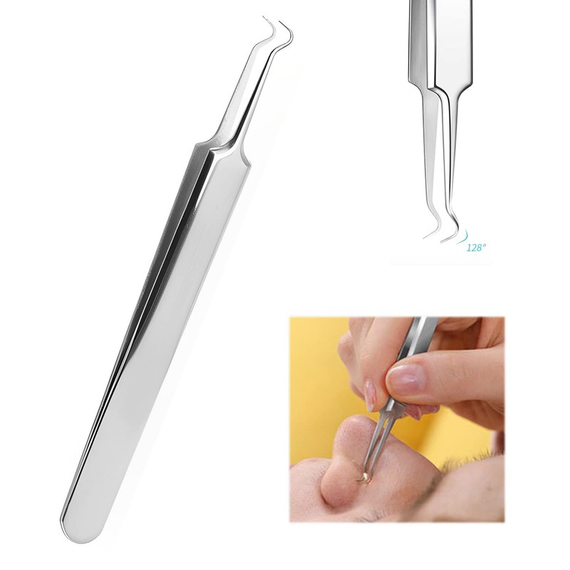 Blackhead Remover Tool Kit,5 Pieces Comedone Extractor Tool,Stainless Steel Comedone