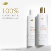 Dove Dermacare Scalp Shampoo, Dryness Itch Relief,12 Ounce