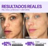 SEYOUL Meso White Serum Iluminador