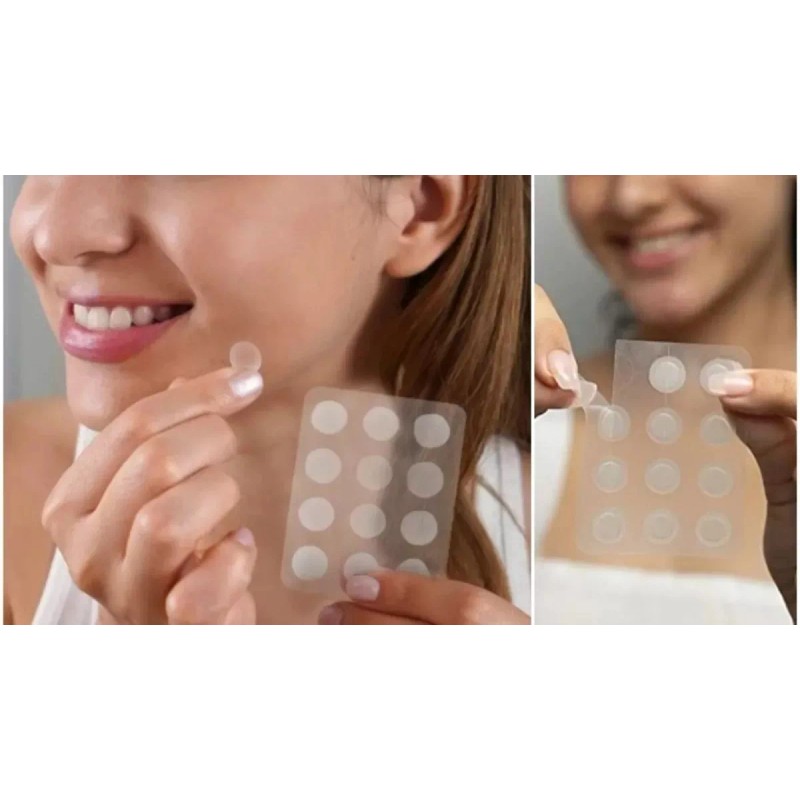 Beauty Parches Circulares Invisibles Acné