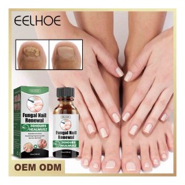 5×unidades Tónico Nutritivo Reparador Hongos En Las Uñas,