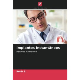 Implantes Instantâneos: Implantes num relance