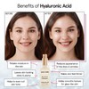 grace & stella Award Winning Hyaluronic Acid Serum for Face