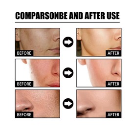 Dark Spot Correcting Glow Serum,5% Niacinamide Serum,Brightening Dark Spot Ser/um,Dar/k Spo/t Remover for Face,Anti-Aging Ser/um,Hydrating Facial Se/rum,Skin Care S/erum for Age/Sun Spots/Acne Marks