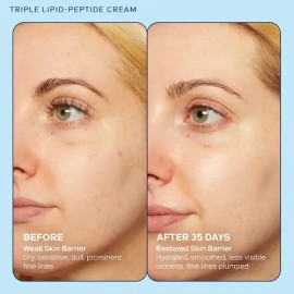 Skinfix Barrier+ Strengthening And Moisturizing 15 Ml Crema