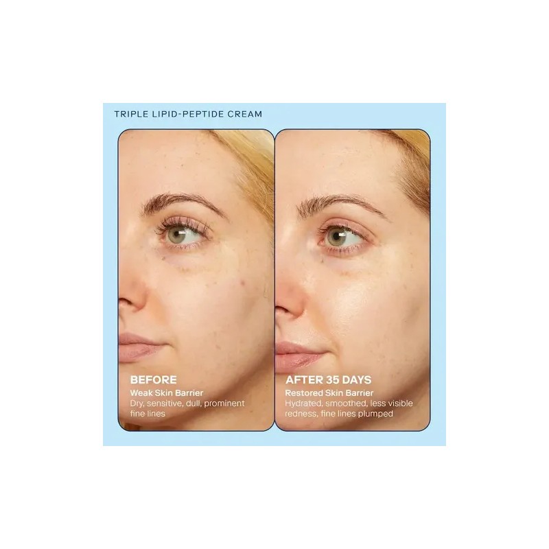 Skinfix Barrier+ Strengthening And Moisturizing 15 Ml Crema