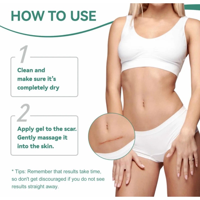 Kit Cicatrices Scar Gel/parche Abdominoplastia, Cirugía 3m Neutra