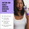 KP Bumps Be Gone, Exfoliating & Hydrating Cream, 3 oz