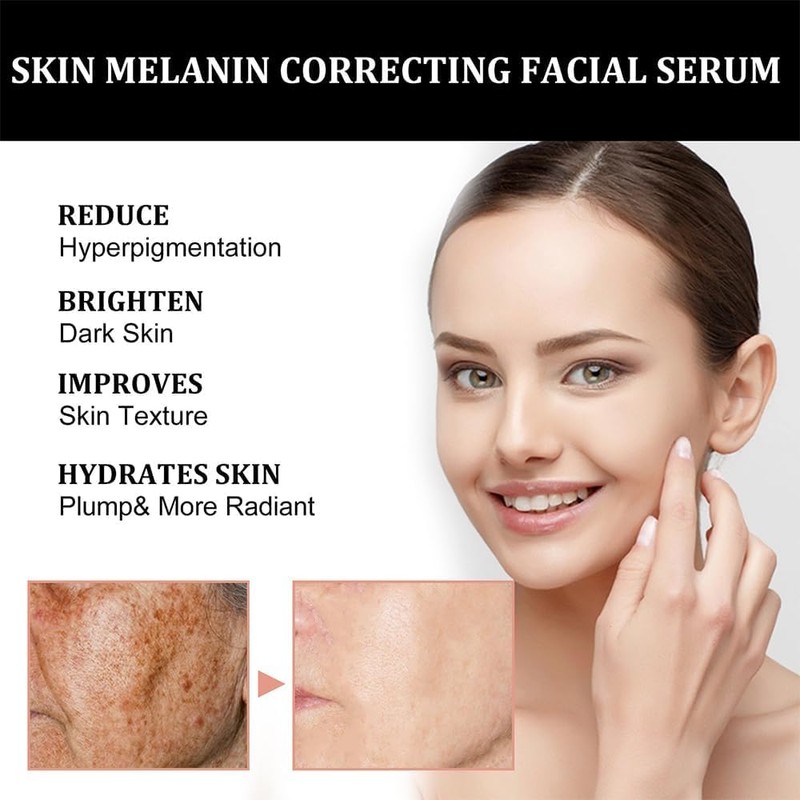 Melanin Correcting Facial Serum, Dark Spot Corrector Daily Face Serum,