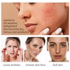 ARCHIDATE Moisturising Leaf Face Mask Pack of 6
