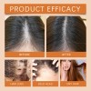 Sérum Para El Crecimiento Del Cabello Hoegoa En Ampolla Nutr