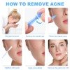 Yeenao Pimple Stickers