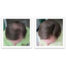 Caboki Hair Loss Concealer 30G (90-Day Supply) (Salt & Pepper - Light)