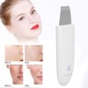 Household Ultrasonic Skin Scrubber Blackhead Removal Face Pore Cleanser InstrumentWhite