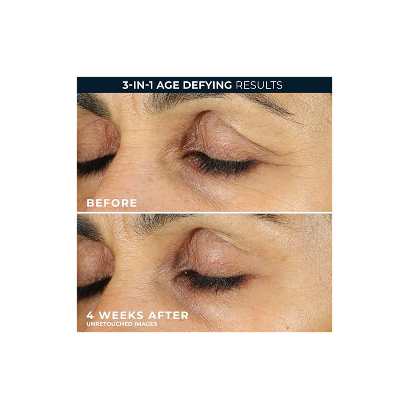 RoC Retinol Correxion Anti-Aging Eye Cream Treatment, 0.5 Fl Oz