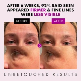 Crema Facial Orgánica Antienvejecimiento Con Matrixyl-3000 Y                                                                                          