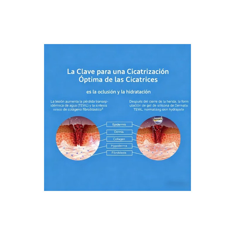 2pcsgel Para Las Cicatrices Momento De Aplicacin Noche Tipo
