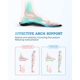 QBK Plantillas Fascitis Plantar, Plantillas Metatarsalgia, Aliviar La Fascitis Plantar, Espolón Calcáneo, Tendinitis De Aquiles, Dolor Metatarsiano, Caminar Y Estar De Pie Por Mucho XS