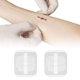 Reparación de laceraciones con puntadas de cremallera sin puntos. Curitas mariposa Quick Clot - Dispositivo de cierre de heridas de emergencia (2 piezas, película fina).