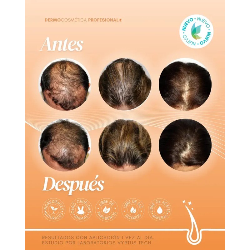 Vial Boost Capilar Biotina Dermapen Células Madre Head Spa