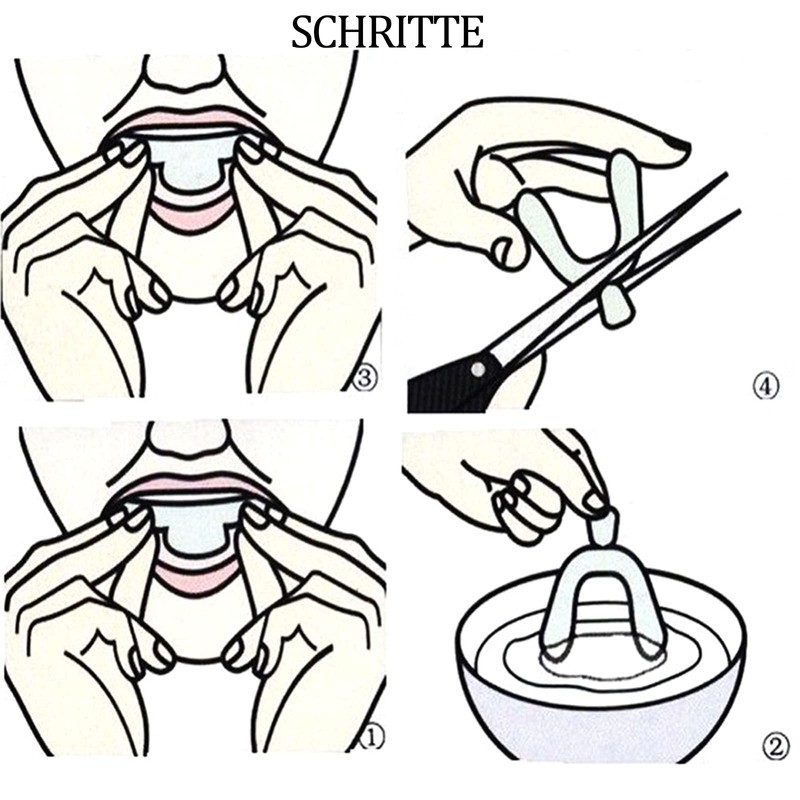aoory Whitening Splints for Teeth Whitening Teeth White Teeth White