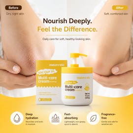 Egg Yolk Oil Body Moisturizer for Dry Skin – Fragrance-Free Squalane Cream for Face, Hands & Body