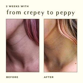 Ayadara Crepey Tratamiento reparador de la piel para brazos y piernas, crema reafirmante de ácido hialurónico para el cuello, crema antiarrugas para l