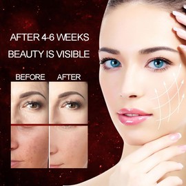 Nulatool Face Mask Light,7 Color Light Facial Skin Care Mask for Face at Home