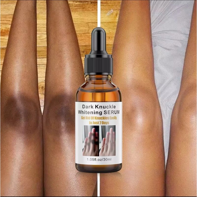 Aromixe 2 Pack Whitening Serum 30ml for Knuckles, Feet, Elbows,