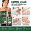 Eelho Líquido Para Hongos En Uñas Cura Hongos Y Onicomicosis