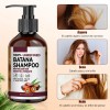 Pack Champú de Batana y Romero para Crecimiento del Cabello,