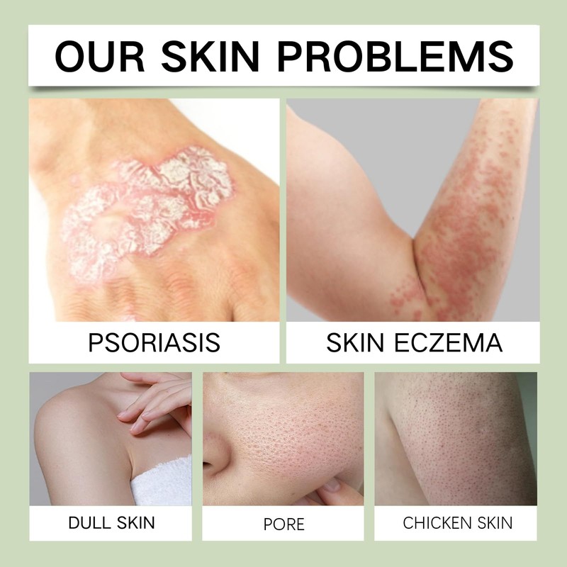 Goats Milk soap - Goat Milk Skincare - Eczema Soap