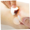 Baluue 3sets Hemostasis Patch Circle Sticker Pads Breathable Woundplast 200pcs*3
