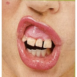 Rubies Karen Billy Bob Big Cletus Hillbilly Monster Rottin Teeth