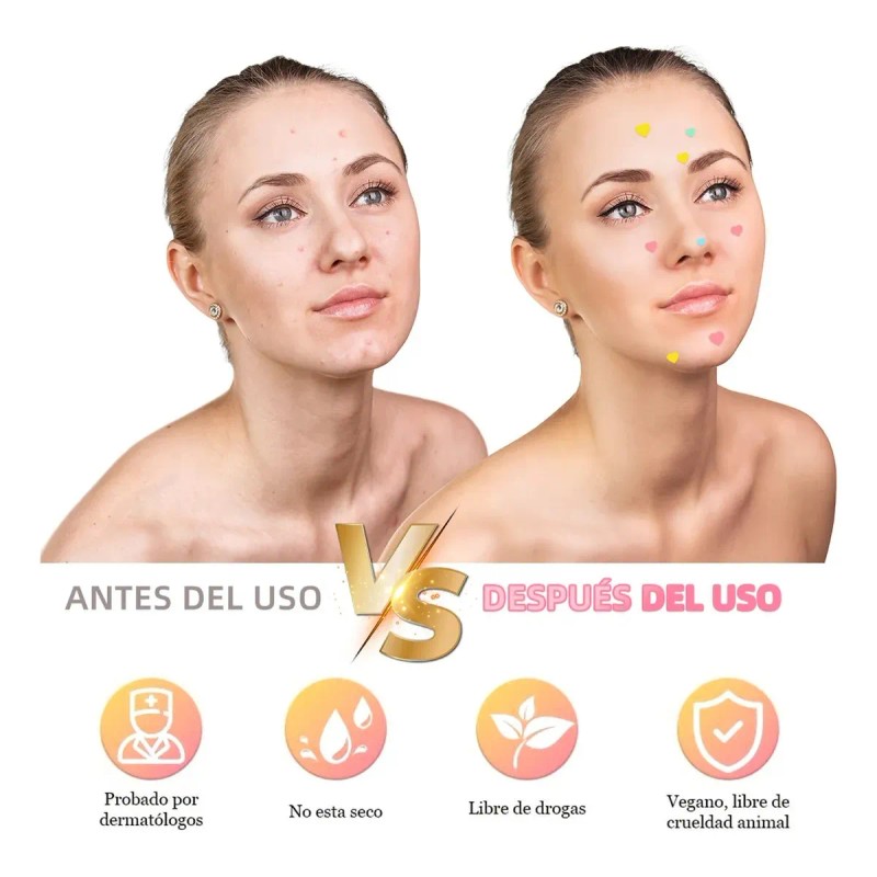 200pzs Mascarillas Estrella Para El Acne Espinillas Granos