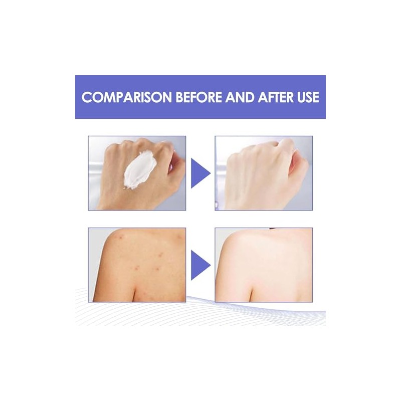 Crema Aclaradora Partes Intimas Aclarador Axilas Aclarar Entrepierna Codos Piernas