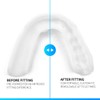 SOVA 3D Bite Splint - 1.6 mm Thin - Tailored