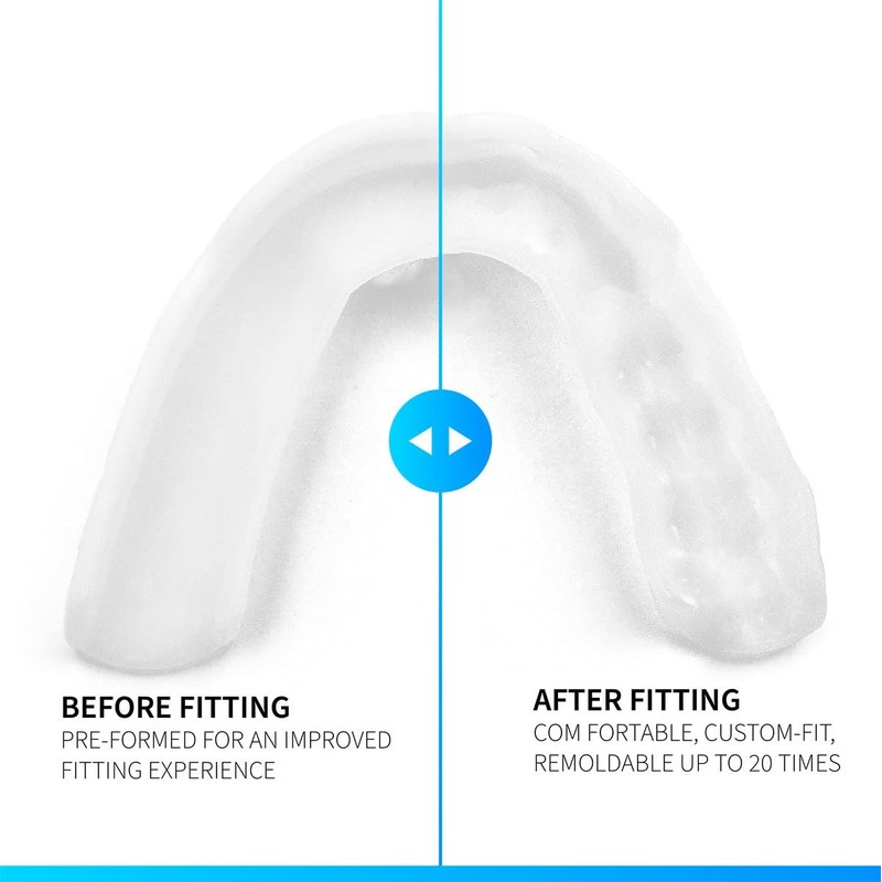 SOVA 3D Bite Splint - 1.6 mm Thin - Tailored