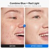 Profey LED Face Mask with 7 Colours, Red Light Mask